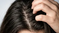 Så blir du av med fett hår hemma